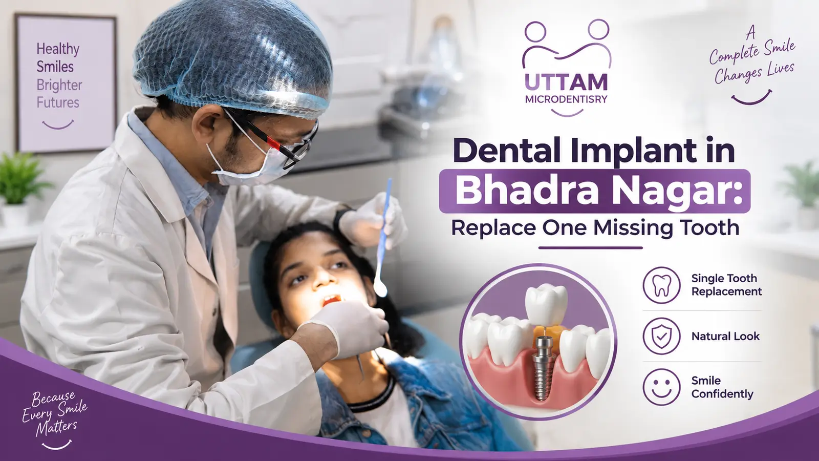 Dental Implant in Bhadra Nagar: Replace One Missing Tooth