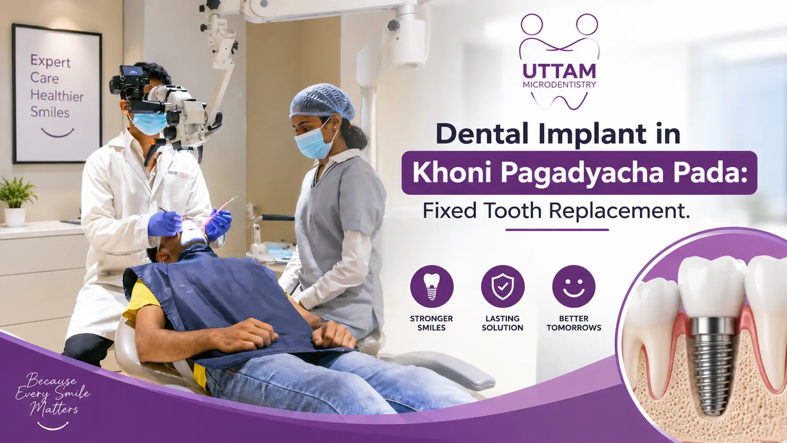 Dental Implant in Khoni Pagadyacha Pada: Fixed Tooth Replacement